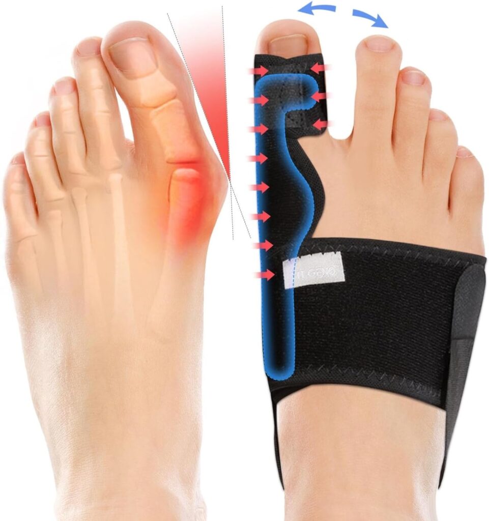 Fitgeno Bunion Corrector Women  Men Big Toe: Foot Straightener Splint Brace - Adjustable Bunyan Correction Orthopedic for Hallux Valgus Pain Relief 2 Pcs